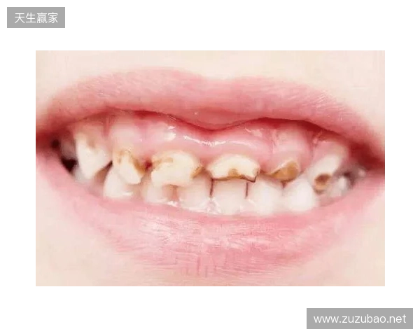 韦林顿确诊上唇部贯通伤;11、21牙半脱位;上颌前牙区牙槽骨骨折